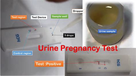 urine drop pregnancy test|pregnancy test results.